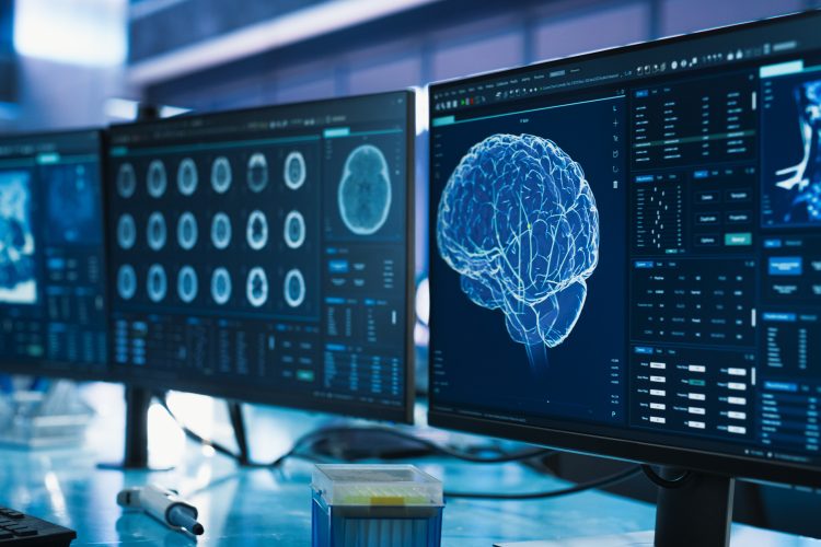 Computer monitors displaying digital visualisations of the human brain used in neuroscience research.