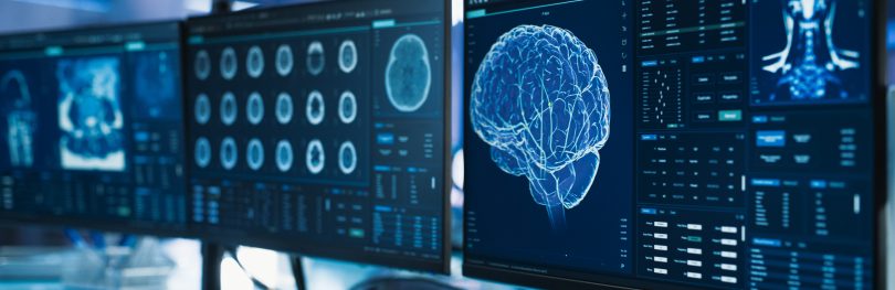 Computer monitors displaying digital visualisations of the human brain used in neuroscience research.