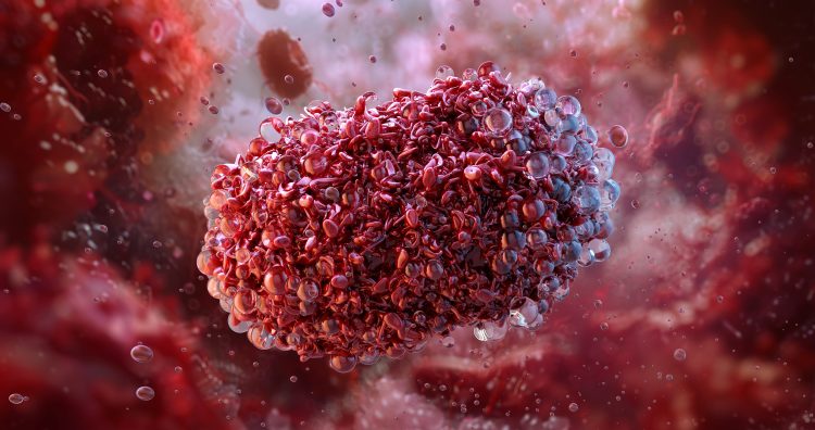 monkeypox virus