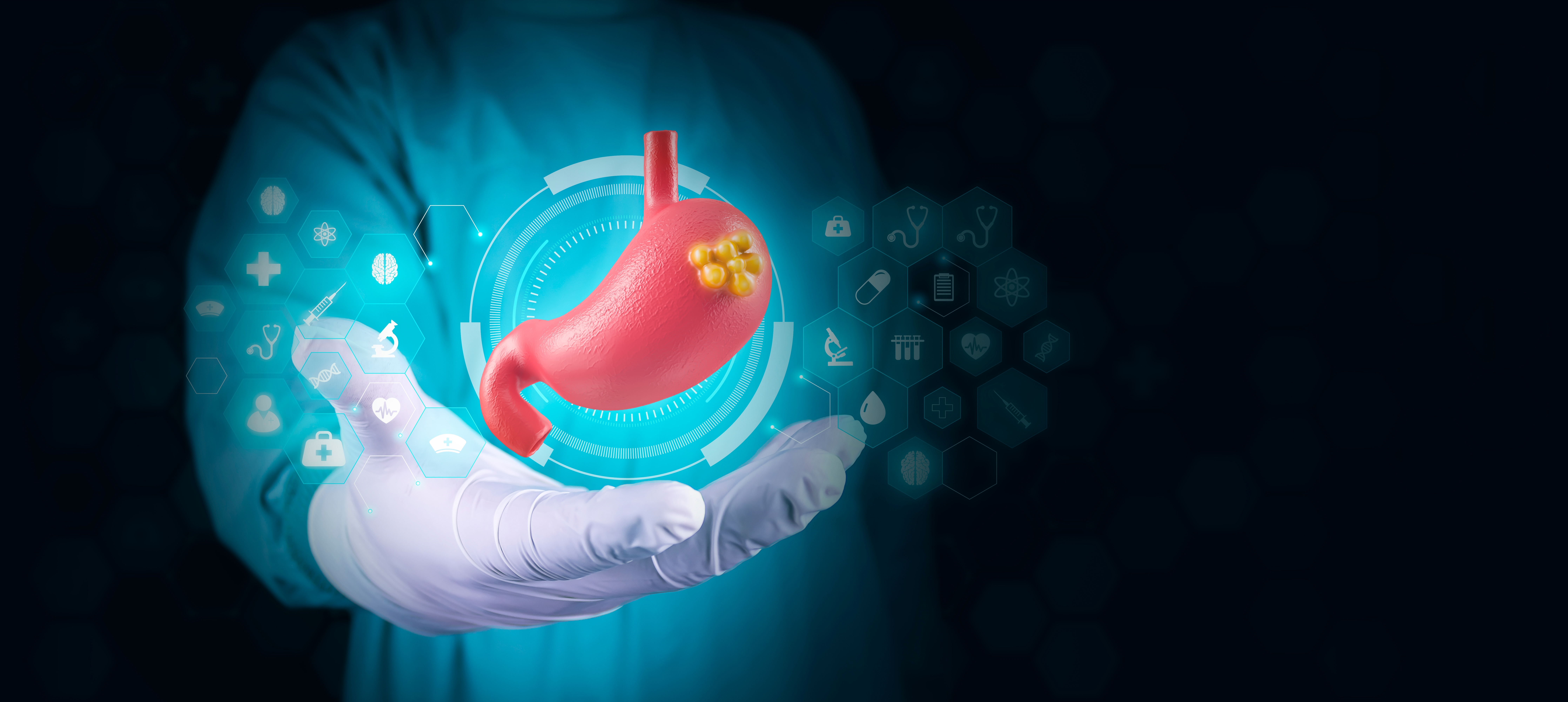 Insilico and MSK partner on AI research for gastroesophageal cancer