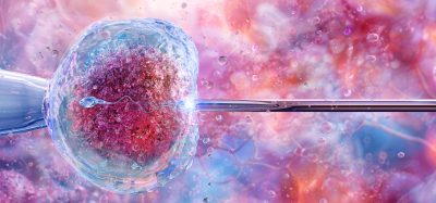3D illustration of in vitro fertilisation showing a sperm cell being injected into a human egg under laboratory conditions