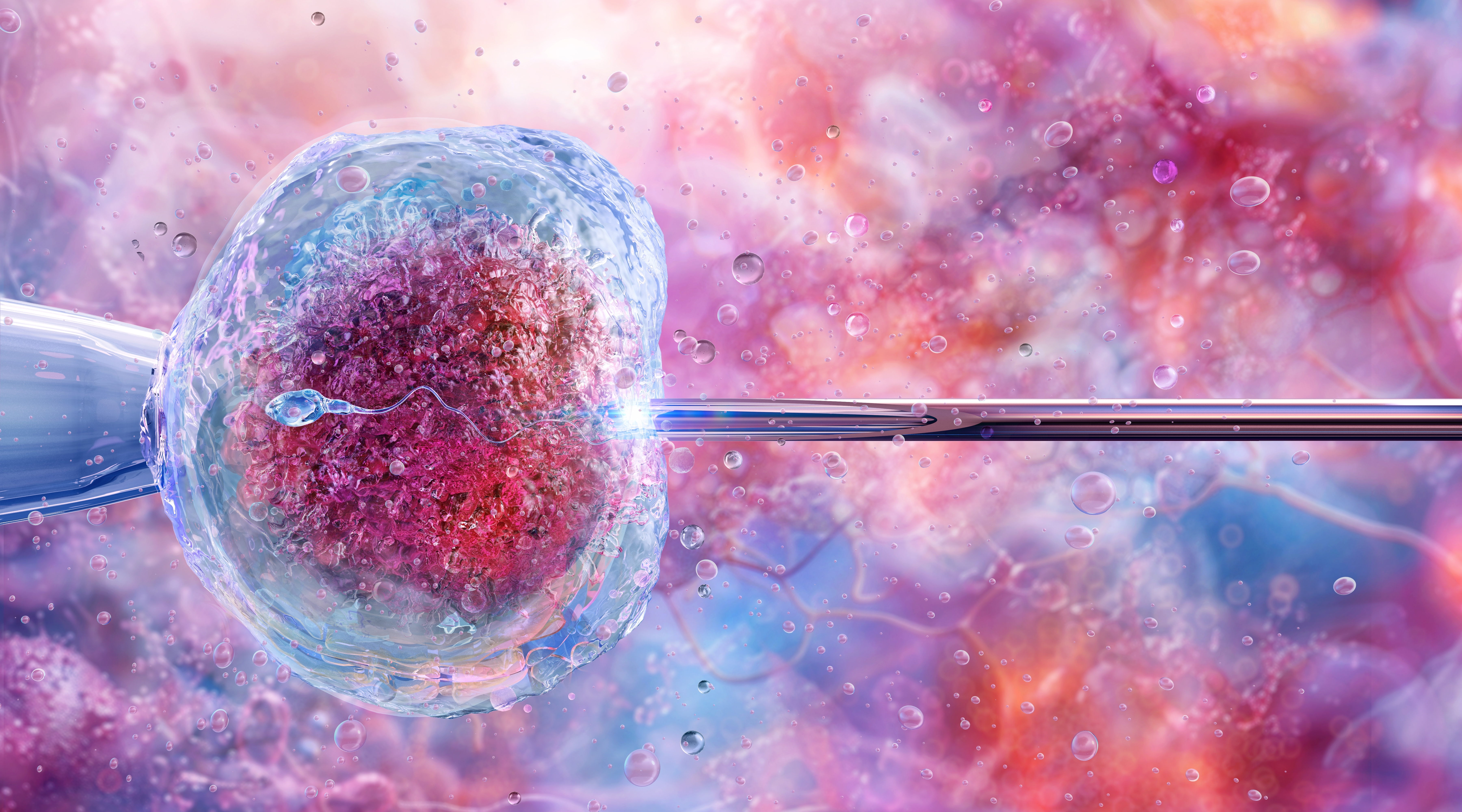 3D illustration of in vitro fertilisation showing a sperm cell being injected into a human egg under laboratory conditions