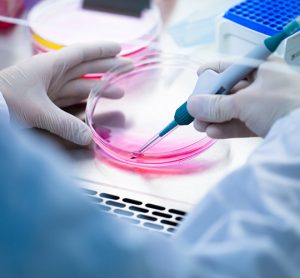 Leveraging innovative strategies for speedy cell line development