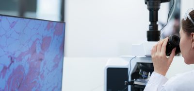 Scientist analysing a tissue sample using a microscope and digital pathology imaging on a computer screen.