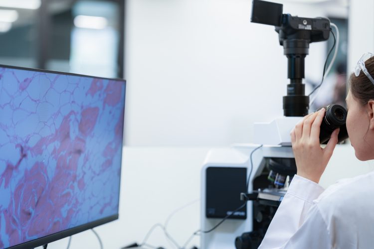 Scientist analysing a tissue sample using a microscope and digital pathology imaging on a computer screen.