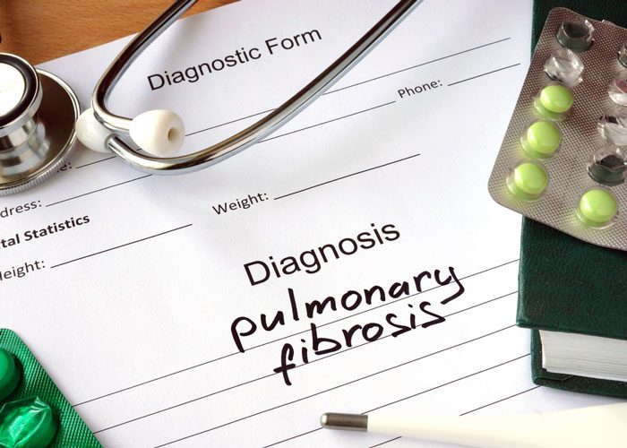 pulmonary fibrosis
