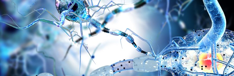 3D illustration of damaged neurons with disrupted myelin sheaths, representing neurodegeneration in conditions such as Alzheimer’s disease.