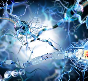 neurons with their myelin sheaths being degraded - iidea of multiple sclerosis