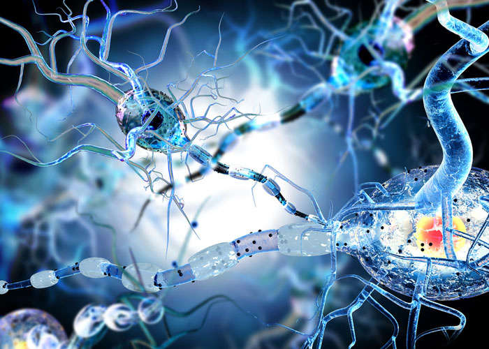 neurons with their myelin sheaths being degraded - iidea of multiple sclerosis