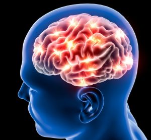 Brain with Alzheimer's