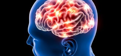Brain with Alzheimer's