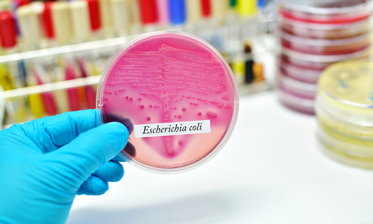 E. coli in petri dish