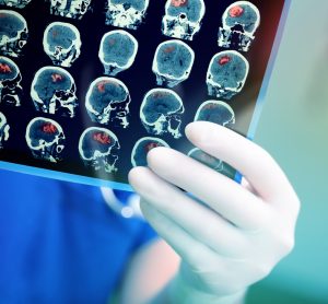 Doctor holding brain scan
