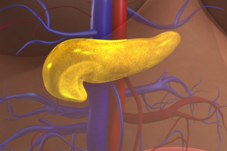 Glowing yellow pancreas in human torso - idea of diabetes, where pancreatic beta cells are destoryed