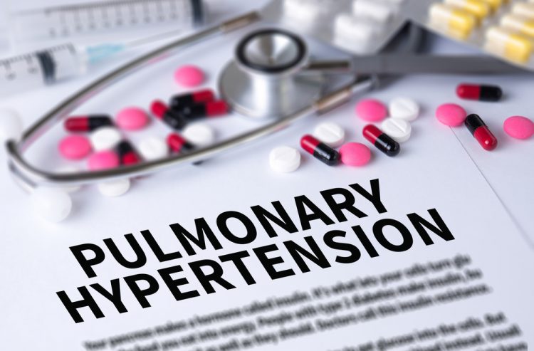 Pills and stethoscope on top of paper that details pulmonary hypertension