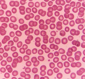 blood