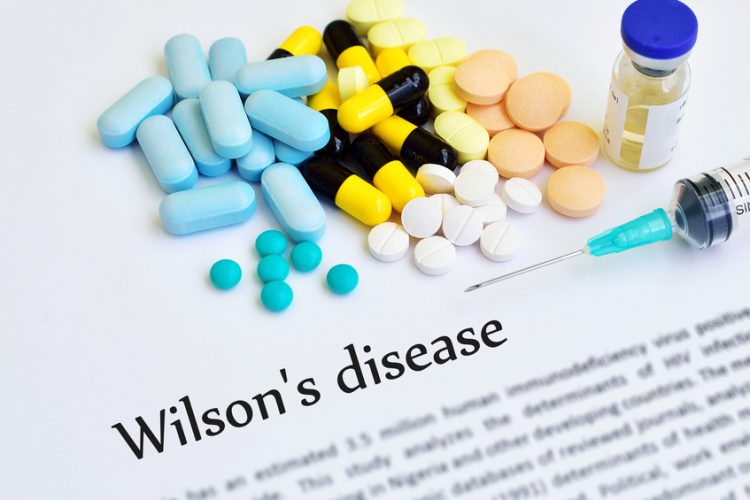 Wilson's disease