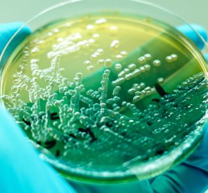 Pseudomonas aeruginosa in petri dish