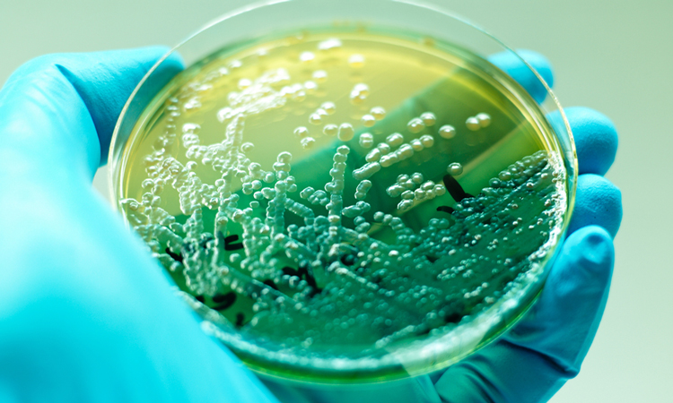 Pseudomonas aeruginosa in petri dish