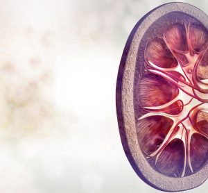 MRI