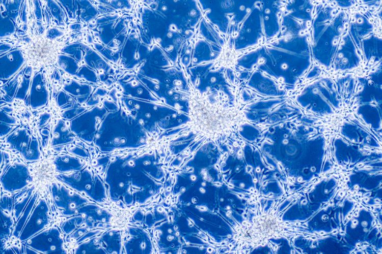 Glioblastoma brain cells