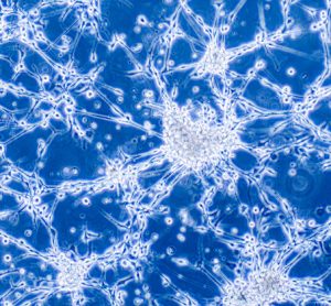 Innovative probe visualises tumours
