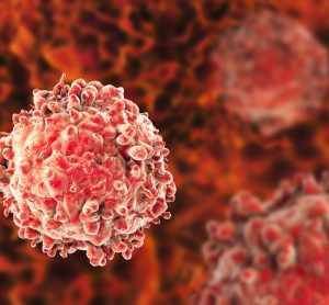 Leukaemia white blood cell