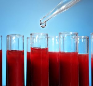 biopsies