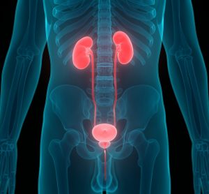 bladder cancer