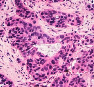 CRISPR-dCas9