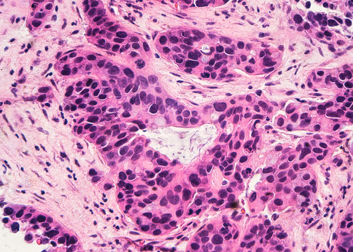 CRISPR-dCas9