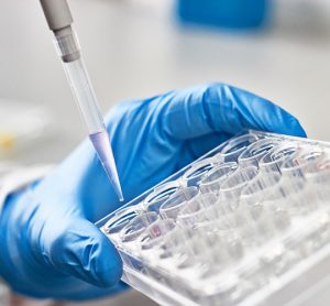 An efficient and effective PIM3 kinase-focused screening cascade for identification of multiple novel and tractable hit series