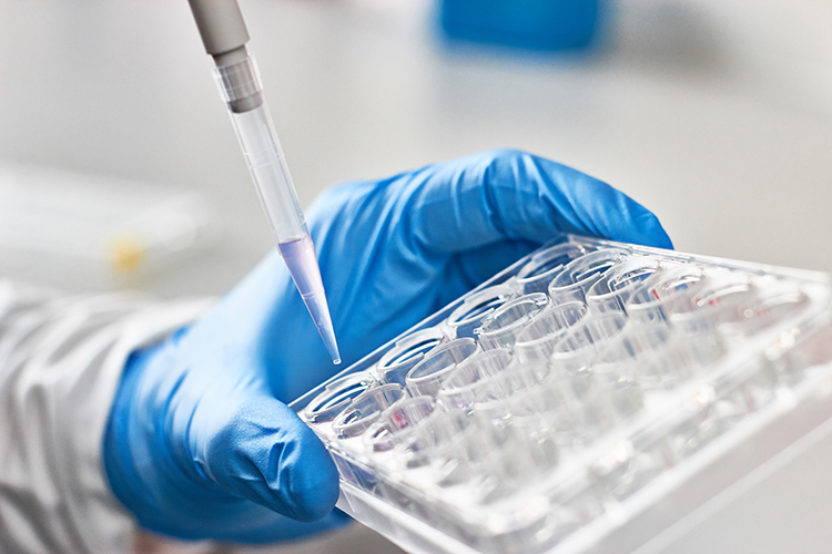 An efficient and effective PIM3 kinase-focused screening cascade for identification of multiple novel and tractable hit series