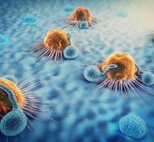 tumour