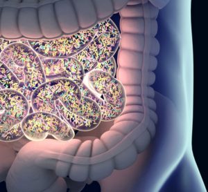 colitis