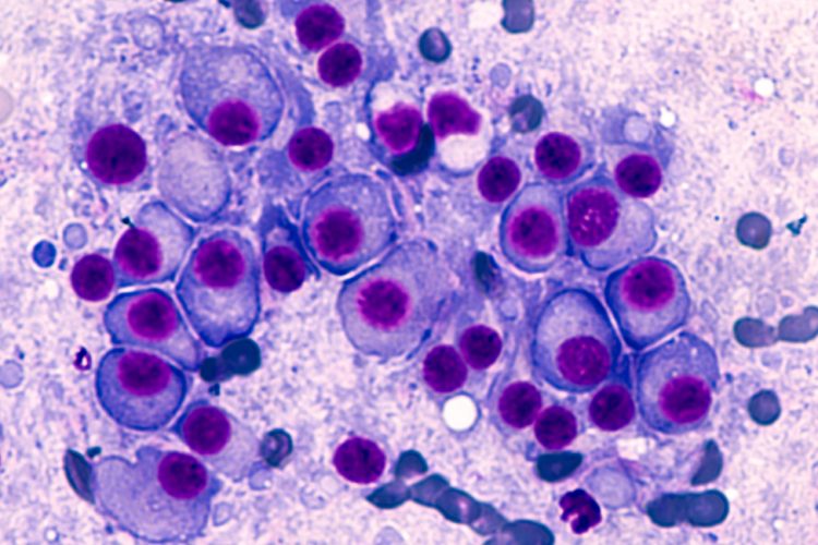 Multiple myeloma cells