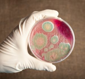 Bacillus anthracis in petri dish