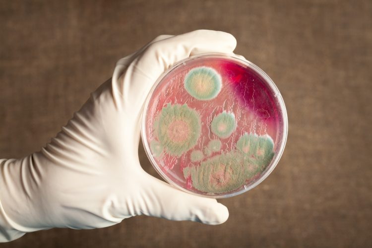 Bacillus anthracis in petri dish
