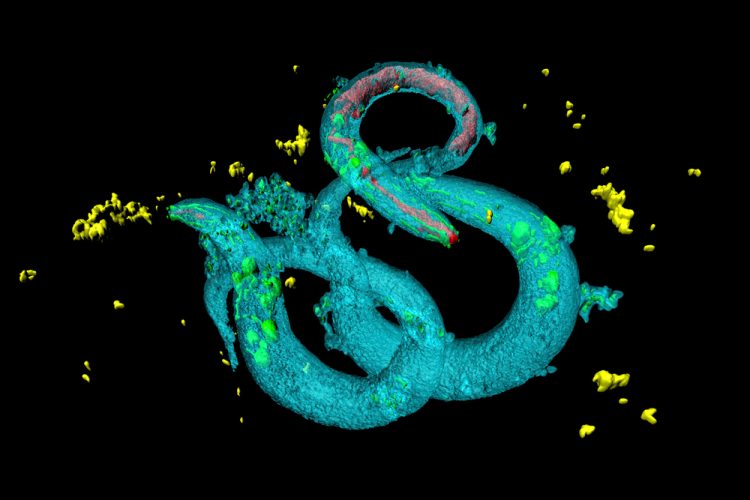 C. elegans - protein for anti-ageing
