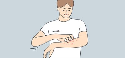 Image showing a cartoon with a skin disease