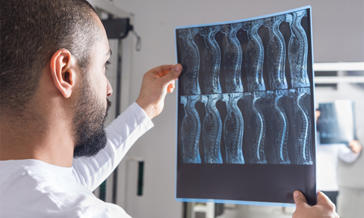 Radiologist analysing X-ray image with human spine in consulting room