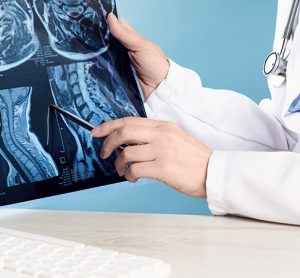 doctors hands holding x-ray or MRI medical imaging with a head and neck condition. Spinal cord, blood vessels and brain. Neuro medicine. Healthcare and medicine. Injury. Bone tissues. Banner