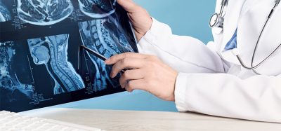 doctors hands holding x-ray or MRI medical imaging with a head and neck condition. Spinal cord, blood vessels and brain. Neuro medicine. Healthcare and medicine. Injury. Bone tissues. Banner