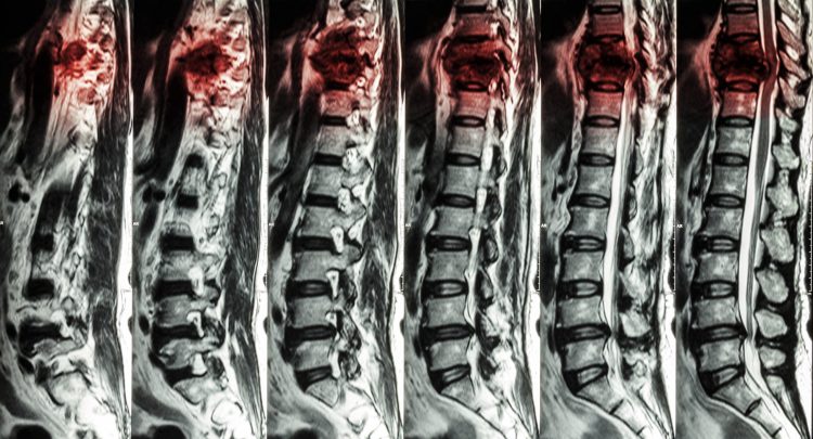 https://www.drugtargetreview.com/wp-content/uploads/spinal-cord-injury-image-scaled-e1583937748801.jpg