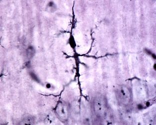 a microglial cell under the microscope
