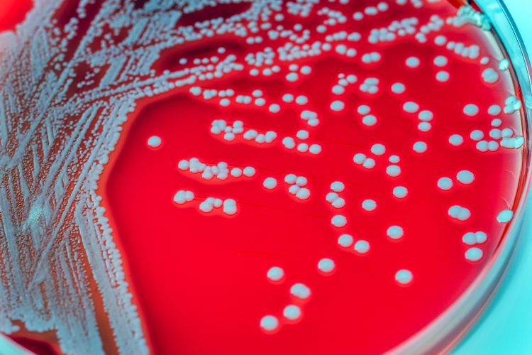 petri dish plate with staphlococcus aureus colonies