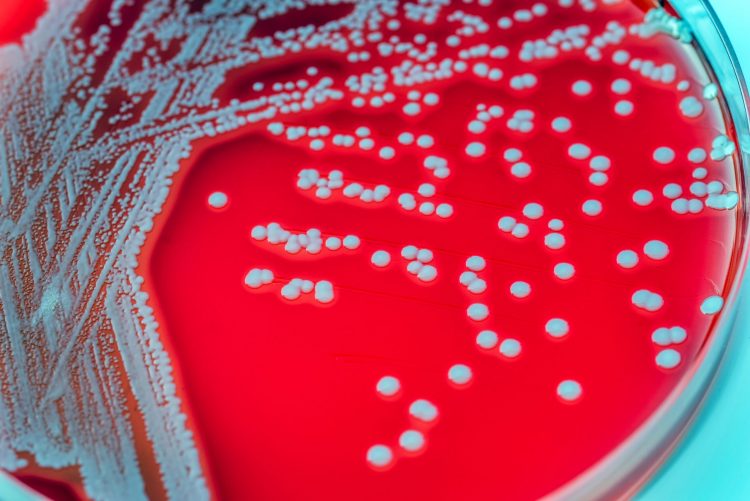 petri dish plate with staphlococcus aureus colonies