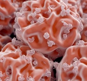 stem-cell-AICLI