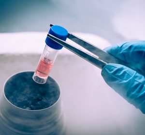 stem cell culture stored in liquid nitrogen