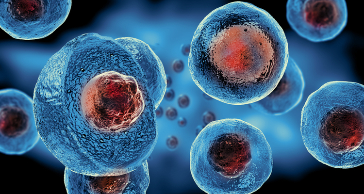 Researchers have made a respiratory model of COVID-19, made from patient-derived stem cells, to understand how the virus affects respiration and which could be used to test possible drugs.